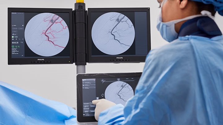 Automatic Vascular Outline(自動血管壁描出機能)