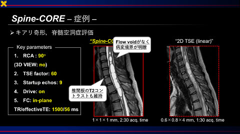 Special Award 講演資料 1