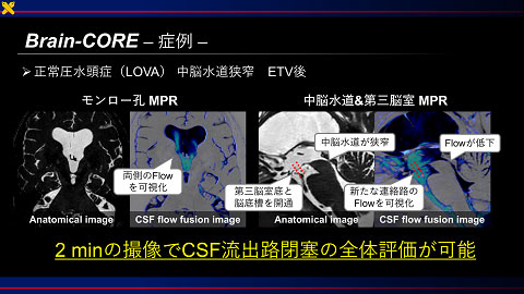 Special Award 講演資料 2