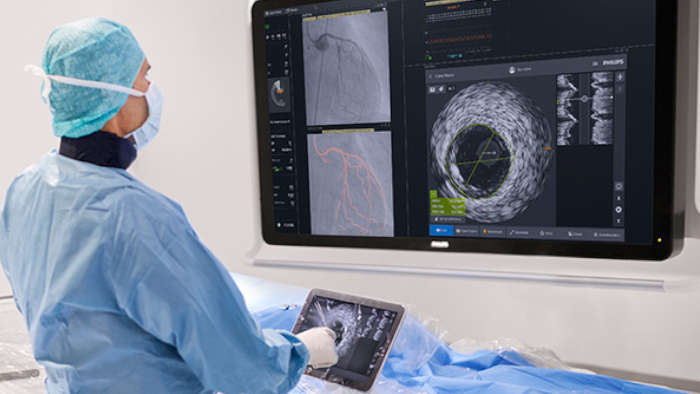 高度イメージングシステム