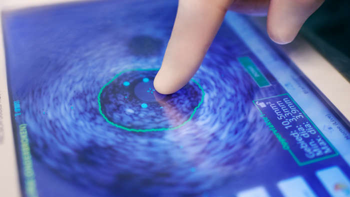 末梢血管治療装置