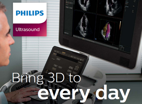 Reproducible EF in seconds - Philips EPIQ 7 HeartModelᴬ&sdot;ᴵ&sdot;（再現性のあるEFを数秒で提供：フィリップス EPIQ 7 HeartModelᴬ&sdot;ᴵ&sdot;）