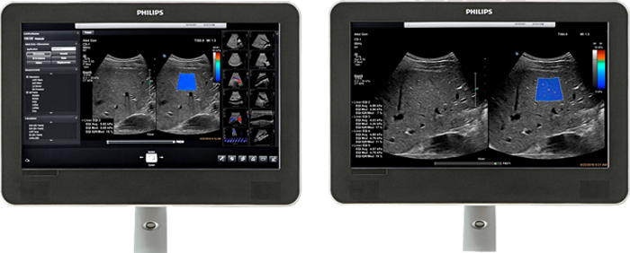 ElastQ超音波画像の表示領域の比較 image