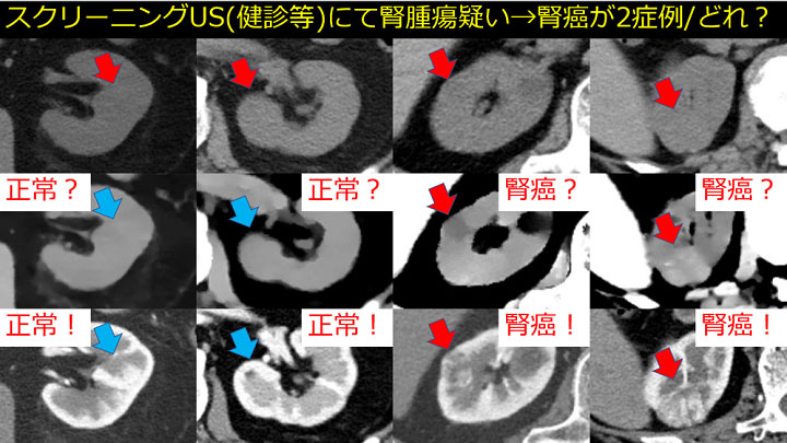 片平和博先生 講演資料
