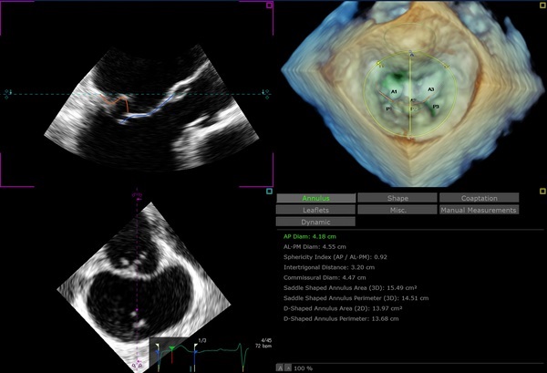 コンピューター画面のスクリーンショット