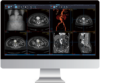 読影PACSビューア image