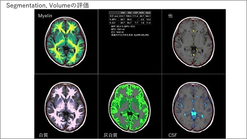  第15回Philips画像診断Webセミナー 講演資料 2