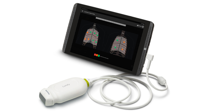 自動で最大のB Line数をカウントする機能です。