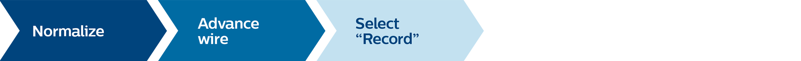 iFR ワークフロー