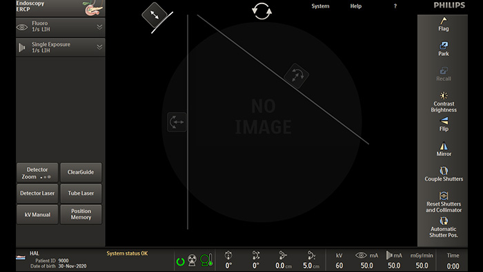 非対称コリメーション