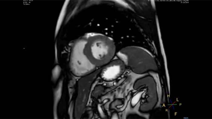 息止め時間、4.8秒