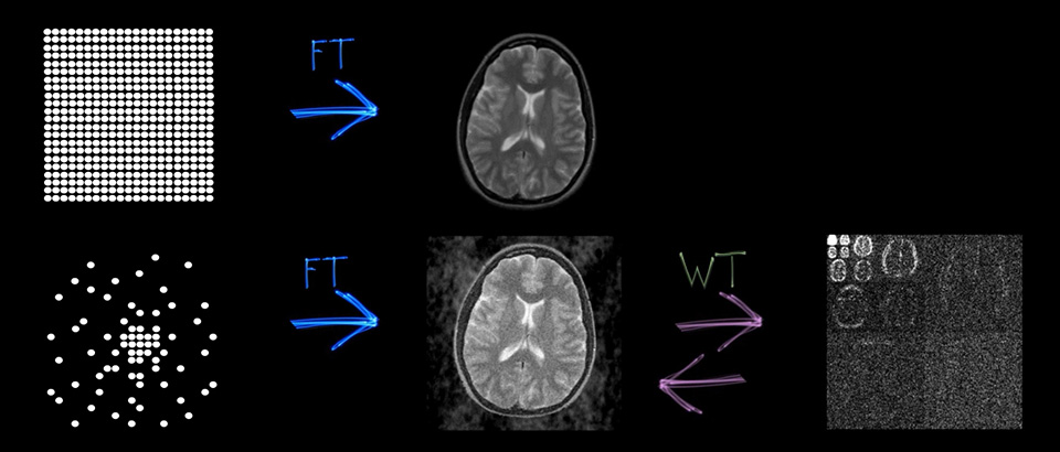 Compressed SENSEを使用して得られる高解像度の画像について、改めて解説したいと思います」