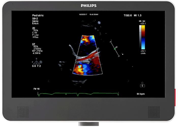 コロナリーサブモード image
