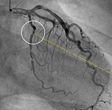 血管の回答画像