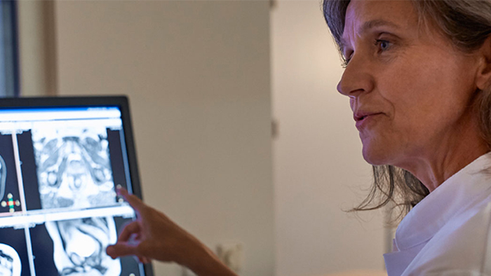 放射線治療におけるMRI