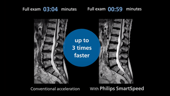 SmartSpeedアニメーションビデオのサムネイル