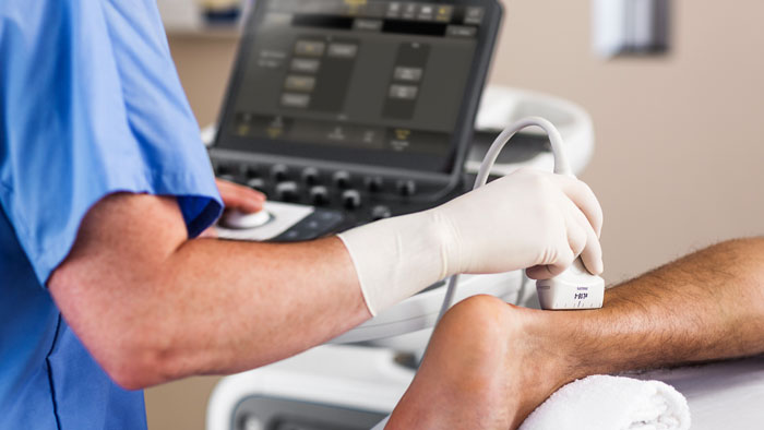 ShearWaveエラストグラフィ image