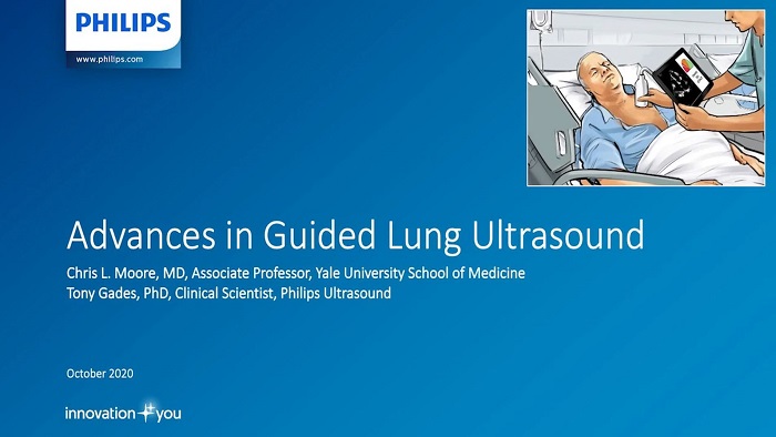 Philips Lumifyによる統合型遠隔超音波診断