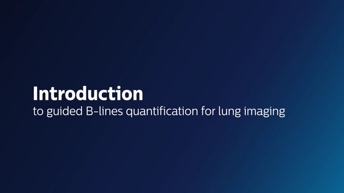 B-Lineカウンティング機能ご紹介します