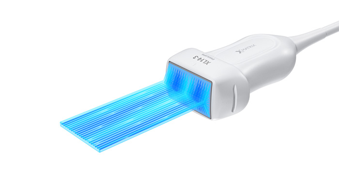 薄いスライスを用いたイメージング image