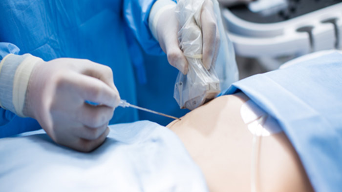 ニードルナビゲーション image