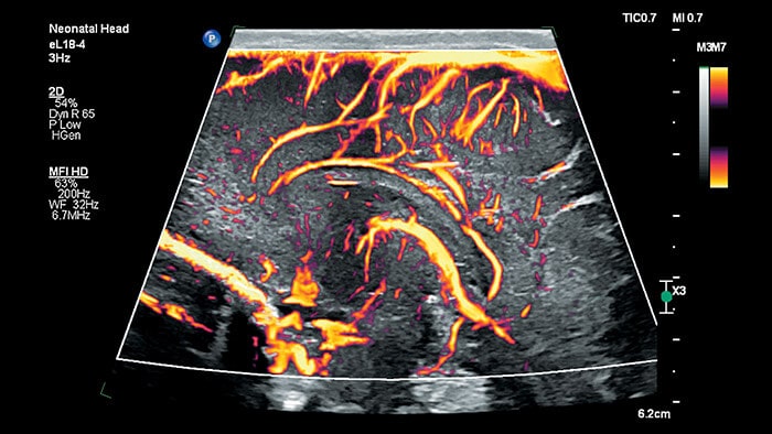 リニアアレイトランスジューサ