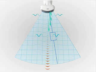 非侵襲的ツールを使用した肝臓評価の簡素化 image