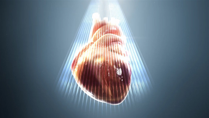 心エコー検査のためのHeartModelᴬ&sdot;ᴵ&sdot;