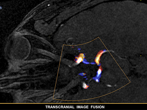 TCDフュージョン image