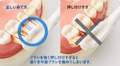 ソニッケアーの基本的な磨き方