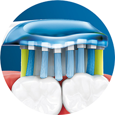 歯列にフィットするブラシ形状