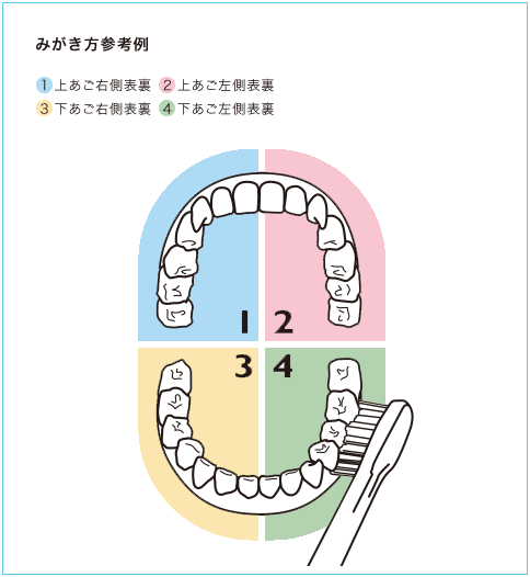 ソニッケアー 使い方 - 磨き方参考例1