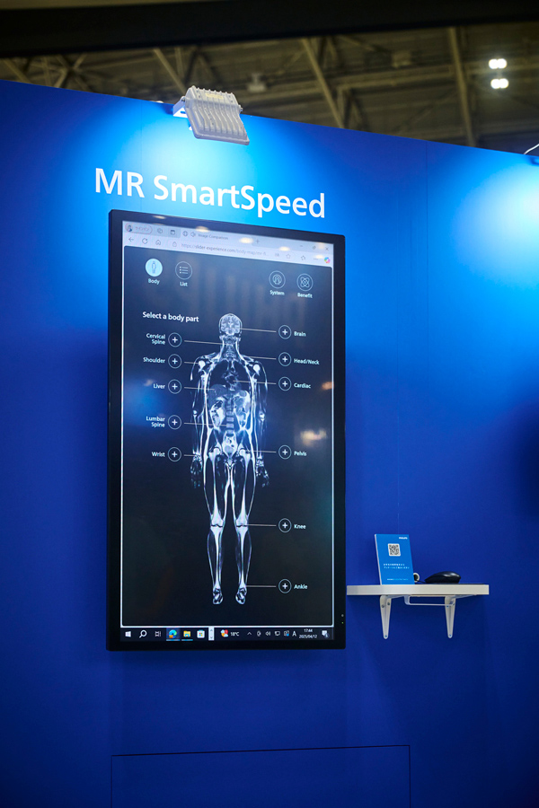 Smartspeed