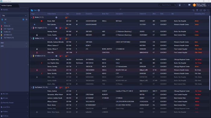 診断用画像読影用のフィリップスRadiology Workflow Orchestratorのデモ