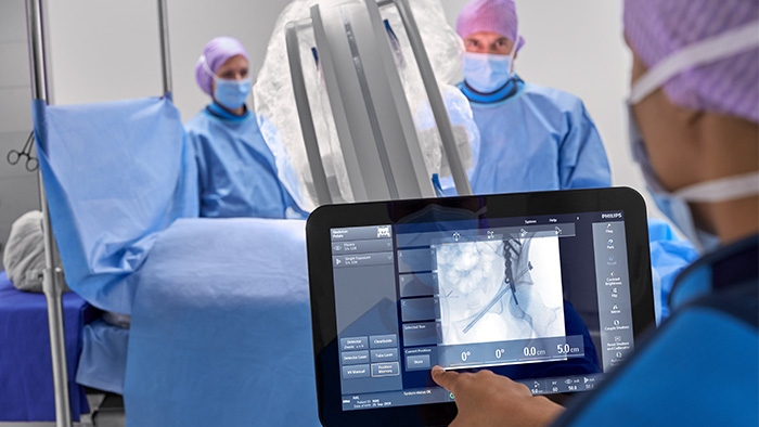 Mobile C-arm for Orthopedics