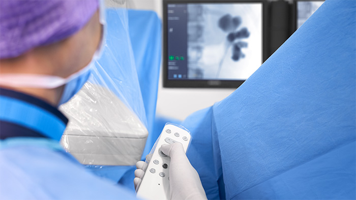 Mobile C-arm for Gastroenterology - Urology