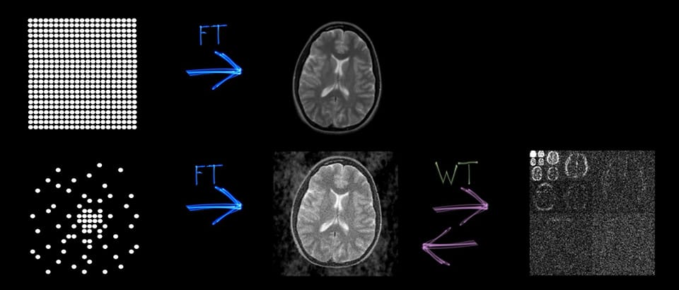 Compressed SENSEを使用して得られる高解像度の画像について、改めて解説したいと思います」