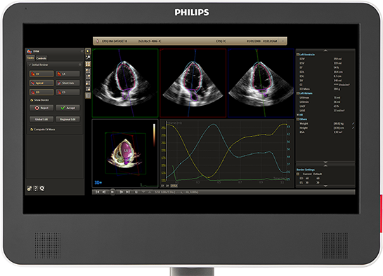 Dynamic Heart Model臨床用途の拡大と診断確度の向上を実現する